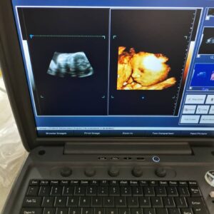 ecomed sonogram