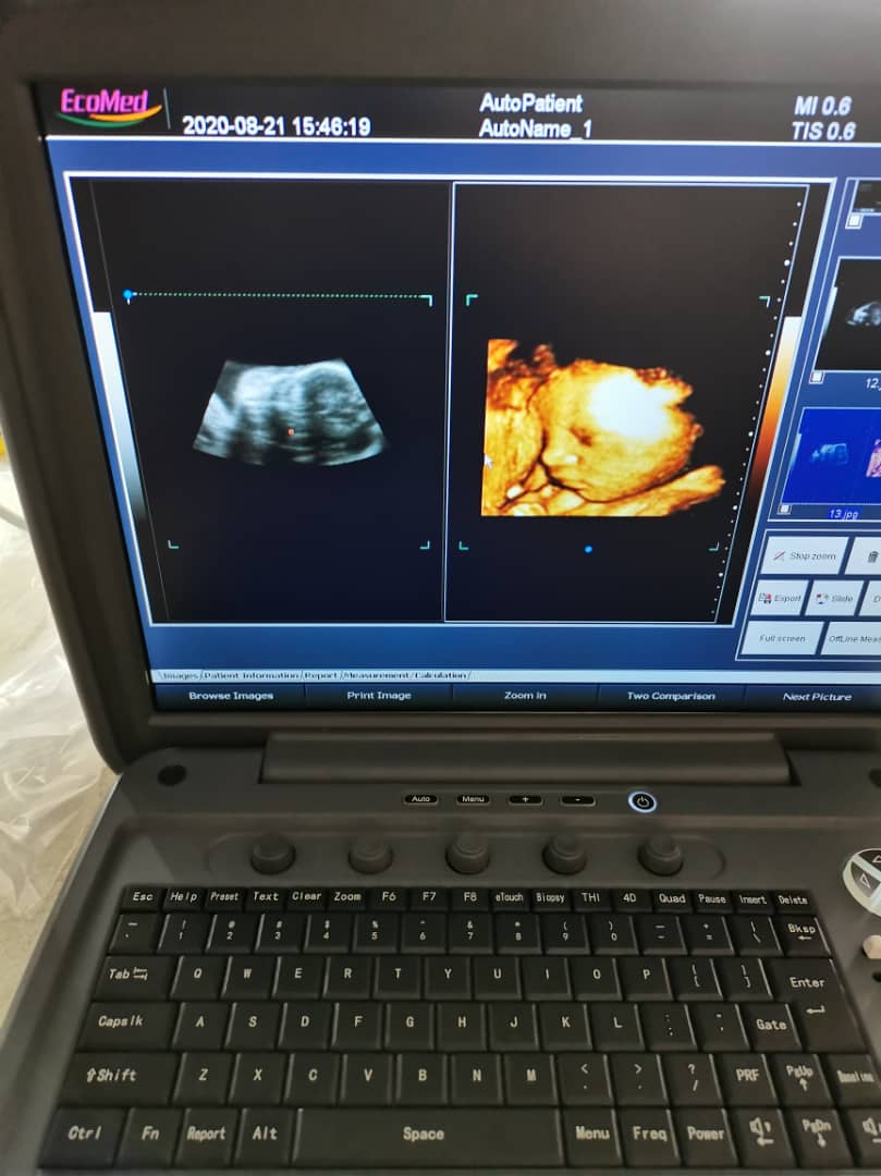 ecomed sonogram ecomed sonogram